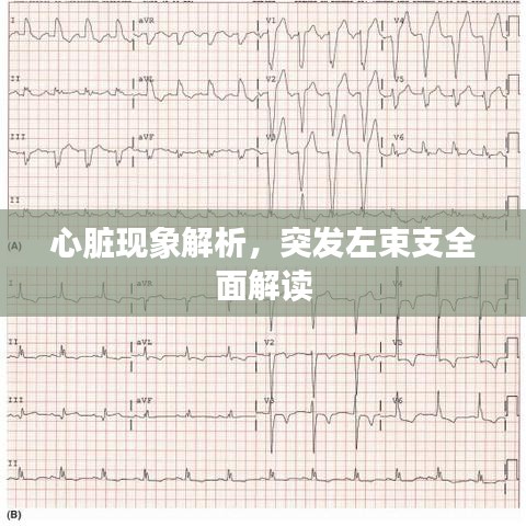 心脏现象解析，突发左束支全面解读