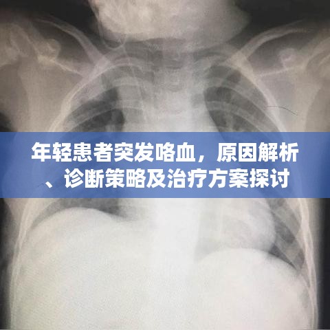 年轻患者突发咯血，原因解析、诊断策略及治疗方案探讨